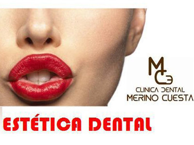 Estetica dental
