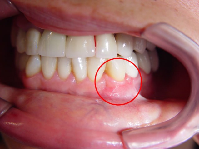 Periodoncia