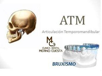 Bruxismo
