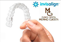 Ortodoncia invisible invisalign